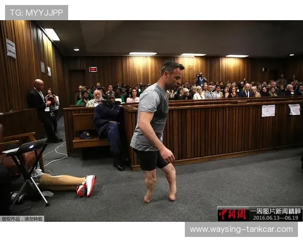 奥斯卡·皮斯托瑞斯家里装了三套假肢，一套跑步用，一套洗澡用，还有一套……专门配西装